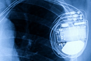 
            Active Implantable Medical Devices