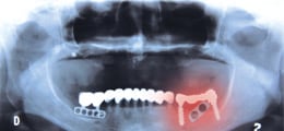 リニューアル開催:歯科医療機器の認証申請を学ぶ1日コース
