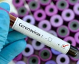 Nouveau Coronavirus (COVID-19)