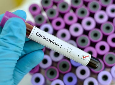 Coronavirus