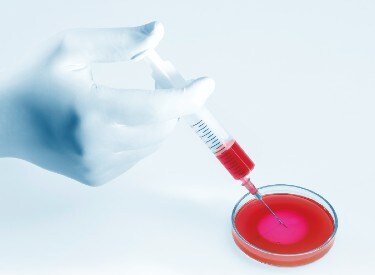 In-vitro-Diagnostika (IVD)