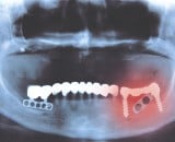 Recursos Ortopédicos y Dentales