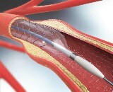Vascular resources