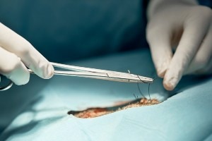 General medical devices General medical devices