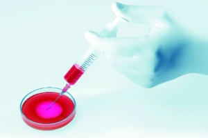 In-vitro diagnostische medische hulpmiddelen