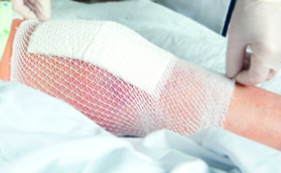 Scopri come i nostri technical specialist possono supportare la tua attività di dispositivi medici per la cura delle ferite e della pelle