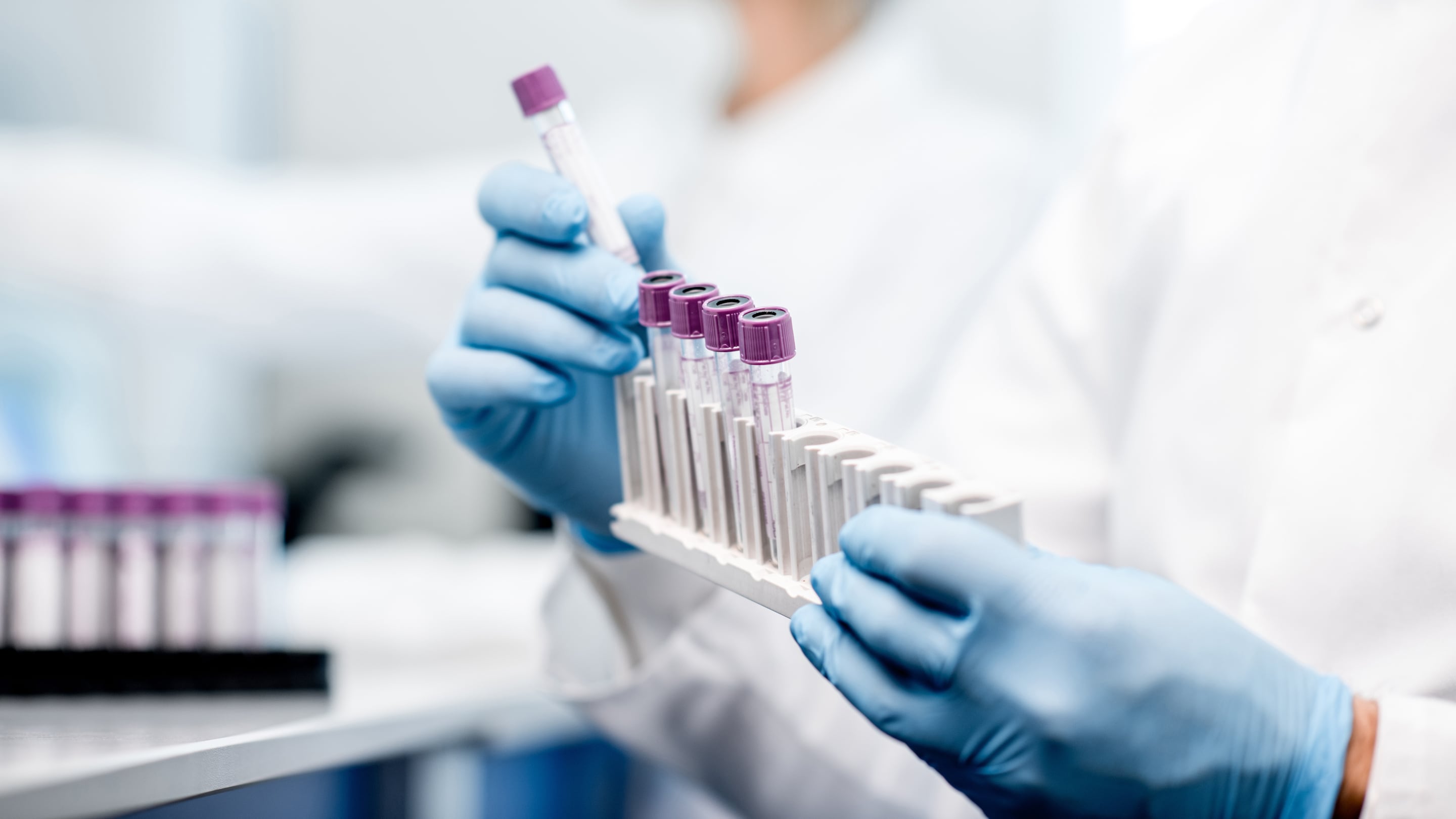 Laboratory assistant putting test tubes into the holder, Close-up view focused on the tubes